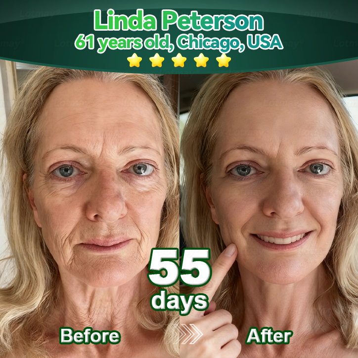 𝐎𝐟𝐟𝐢𝐜𝐢𝐚𝐥𝐥𝐲 𝐀𝐮𝐭𝐡𝐨𝐫𝐢𝐬𝐞𝐝 𝐄𝐱𝐜𝐥𝐮𝐬𝐢𝐯𝐞 𝐄𝐝𝐢𝐭𝐢𝐨𝐧 | 𝑳𝑜𝑡𝑚𝑎𝒚® Stem Cell & Collagen Peptide Oral Drops🎇 (Lift & Firm Sagging Skin & Reduce Wrinkle Formation)🌱