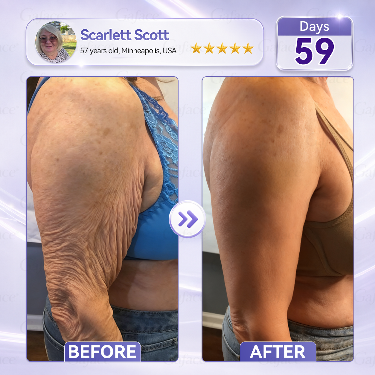 🧧🌿𝐆𝐚𝐟𝐚𝐜𝐞® 𝐂𝐨𝐥𝐥𝐚𝐠𝐞𝐧 & 𝐅𝐮𝐥𝐥𝐞𝐫𝐞𝐧𝐞 𝐑𝐨𝐥𝐥𝐞𝐫 𝐅𝐢𝐫𝐦𝐢𝐧𝐠 𝐂𝐫𝐞𝐚𝐦