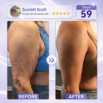 🧧🌿𝐆𝐚𝐟𝐚𝐜𝐞® 𝐂𝐨𝐥𝐥𝐚𝐠𝐞𝐧 & 𝐅𝐮𝐥𝐥𝐞𝐫𝐞𝐧𝐞 𝐑𝐨𝐥𝐥𝐞𝐫 𝐅𝐢𝐫𝐦𝐢𝐧𝐠 𝐂𝐫𝐞𝐚𝐦