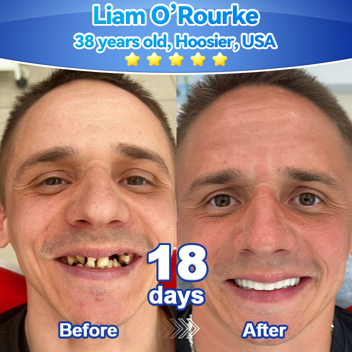 ✨🎇𝑃𝑖𝑐𝑑𝑜® 𝑆𝑡𝑒𝑚 𝐶𝑒𝑙𝑙 𝐺𝑖𝑛𝑔𝑖𝑣𝑎𝑙 𝑅𝑒𝑝𝑎𝑖𝑟 𝑀𝑜𝑢𝑠𝑠𝑒(🦷Promote Tooth Regrowth • Remove Tartar • Strengthen Gums • Deep Clean & Freshen Breath)