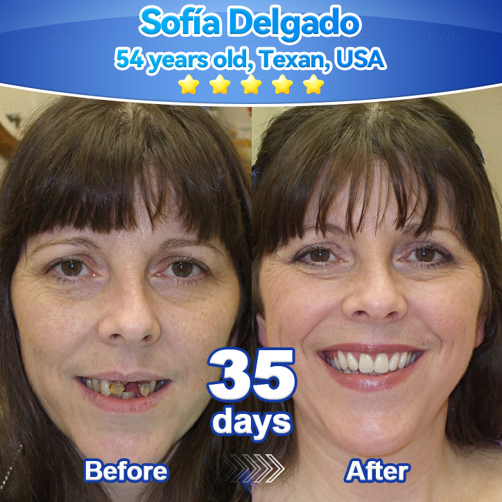 ✨🎇𝑃𝑖𝑐𝑑𝑜® 𝑆𝑡𝑒𝑚 𝐶𝑒𝑙𝑙 𝐺𝑖𝑛𝑔𝑖𝑣𝑎𝑙 𝑅𝑒𝑝𝑎𝑖𝑟 𝑀𝑜𝑢𝑠𝑠𝑒(🦷Promote Tooth Regrowth • Remove Tartar • Strengthen Gums • Deep Clean & Freshen Breath)