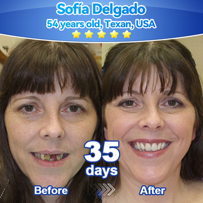 ✨🎇𝑃𝑖𝑐𝑑𝑜® 𝑆𝑡𝑒𝑚 𝐶𝑒𝑙𝑙 𝐺𝑖𝑛𝑔𝑖𝑣𝑎𝑙 𝑅𝑒𝑝𝑎𝑖𝑟 𝑀𝑜𝑢𝑠𝑠𝑒(🦷Promote Tooth Regrowth • Remove Tartar • Strengthen Gums • Deep Clean & Freshen Breath)