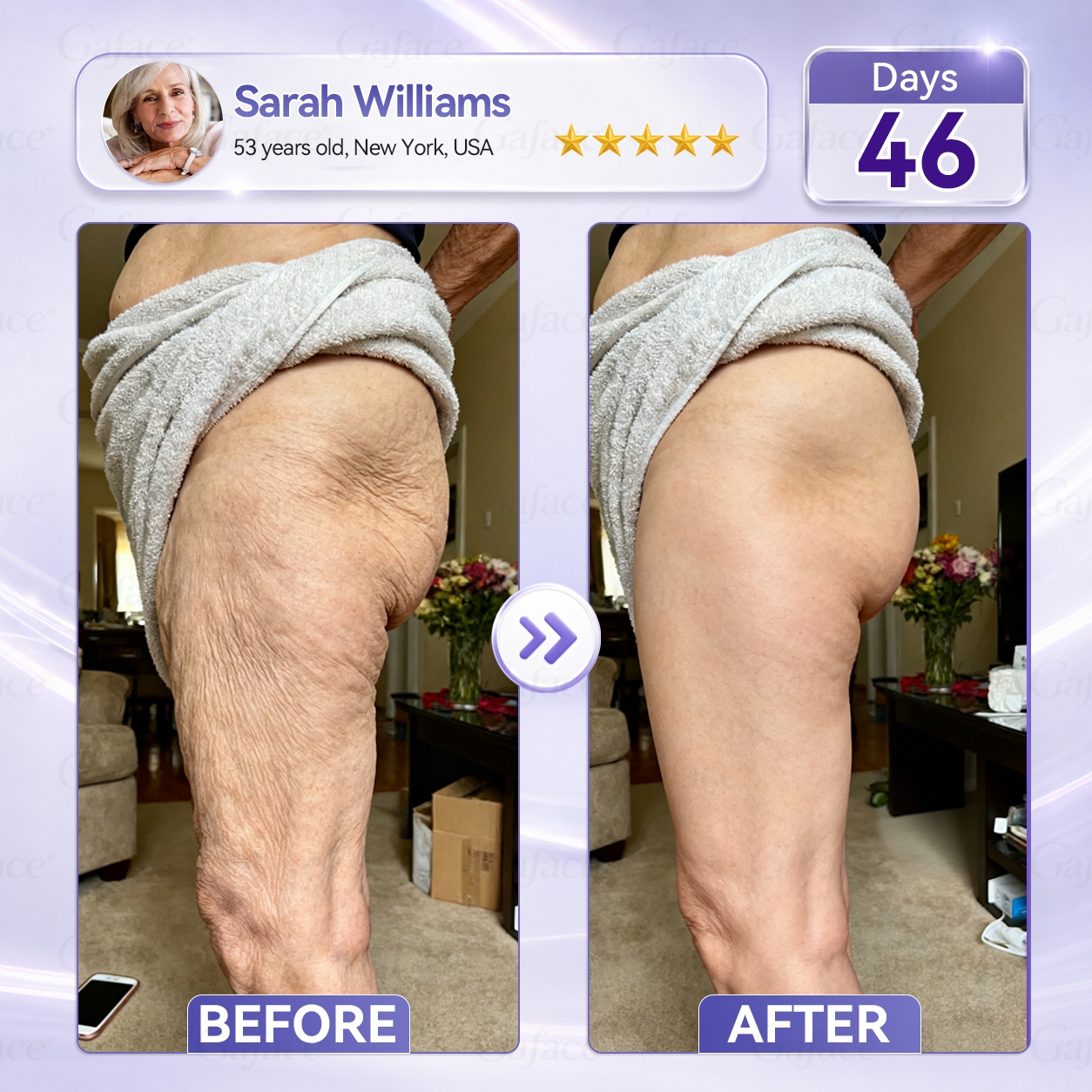 🧧🌿𝐆𝐚𝐟𝐚𝐜𝐞® 𝐂𝐨𝐥𝐥𝐚𝐠𝐞𝐧 & 𝐅𝐮𝐥𝐥𝐞𝐫𝐞𝐧𝐞 𝐑𝐨𝐥𝐥𝐞𝐫 𝐅𝐢𝐫𝐦𝐢𝐧𝐠 𝐂𝐫𝐞𝐚𝐦
