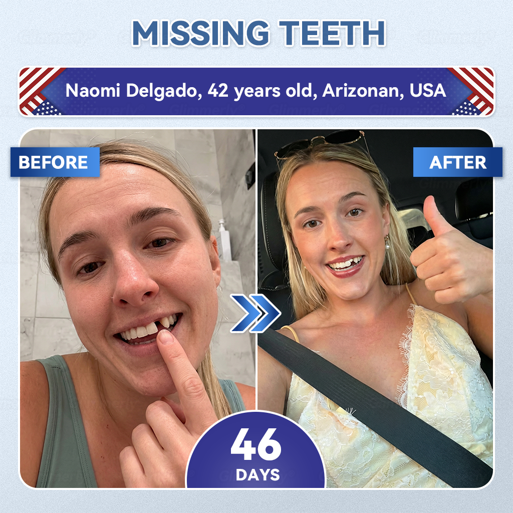 🌿🦷𝐆𝐥𝐢𝐦𝐦𝐞𝐫𝐥𝐲® 𝐓𝐢𝐝𝐞𝐠𝐥𝐮𝐬𝐢𝐛 𝐓𝐨𝐨𝐭𝐡 & 𝐆𝐮𝐦 𝐑𝐞𝐩𝐚𝐢𝐫 𝐌𝐢𝐜𝐫𝐨𝐧𝐞𝐞𝐝𝐥𝐞 𝐏𝐚𝐭𝐜𝐡 💕 | 𝐀𝐝𝐯𝐚𝐧𝐜𝐞𝐝 𝐒𝐭𝐞𝐦-𝐂𝐞𝐥𝐥 𝐀𝐜𝐭𝐢𝐯𝐚𝐭𝐢𝐨𝐧 𝐓𝐞𝐞𝐭𝐡 𝐒𝐭𝐫𝐢𝐩𝐬(🦷𝐑𝐞𝐛𝐮𝐢𝐥𝐝 𝐄𝐧𝐚𝐦𝐞𝐥 & 𝐃𝐞𝐧𝐭𝐢𝐧 • 𝐒𝐭𝐫𝐞𝐧𝐠𝐭𝐡𝐞𝐧 𝐆𝐮𝐦𝐬 • 𝐄𝐫𝐚𝐝𝐢𝐜𝐚𝐭𝐞 𝐓𝐚𝐫𝐭𝐚𝐫 & 𝐎𝐝𝐨𝐫 • 𝐒𝐭𝐨𝐩 𝐓𝐨𝐨𝐭𝐡 𝐒𝐞𝐧𝐬𝐢𝐭𝐢𝐯𝐢𝐭𝐲)