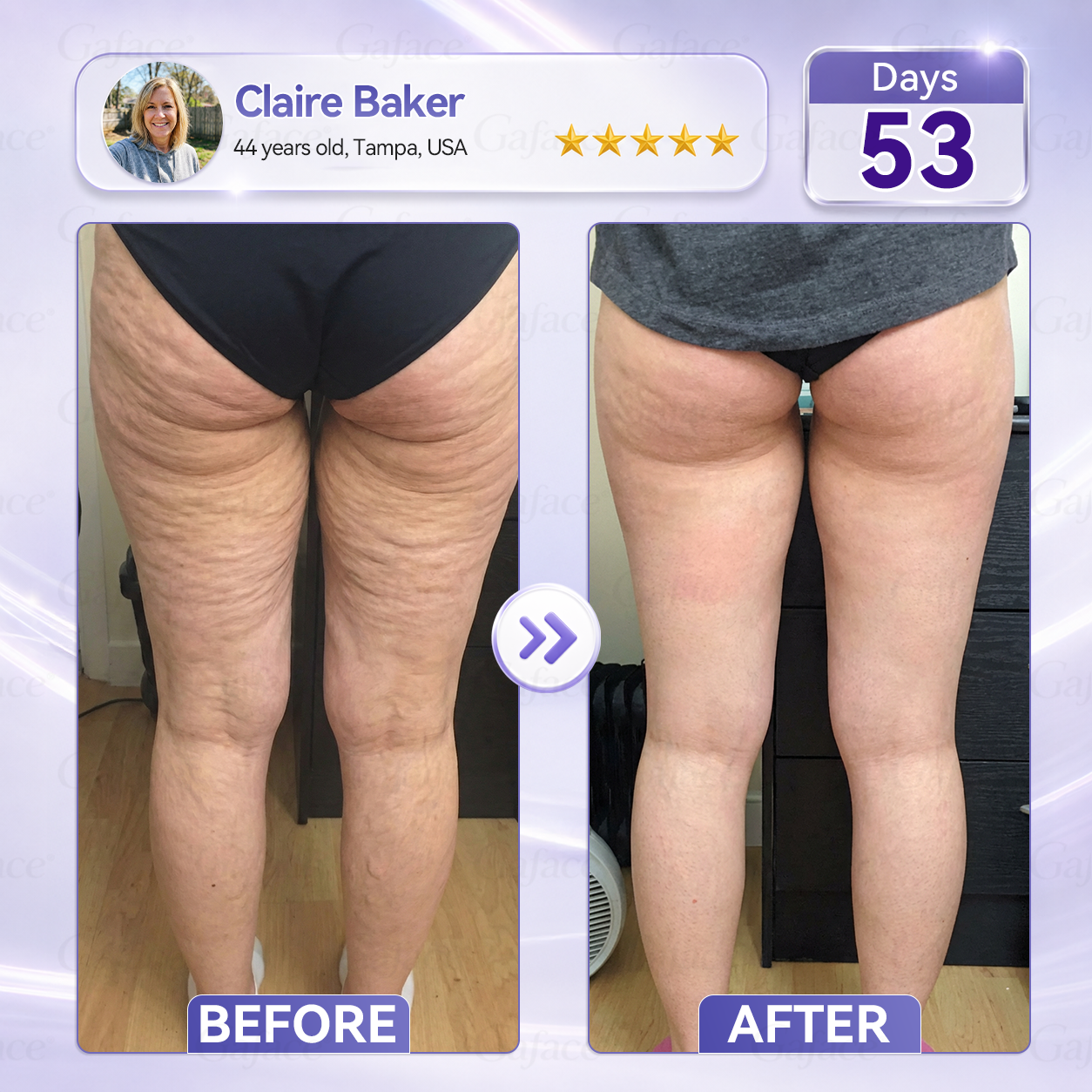 🧧🌿𝐆𝐚𝐟𝐚𝐜𝐞® 𝐂𝐨𝐥𝐥𝐚𝐠𝐞𝐧 & 𝐅𝐮𝐥𝐥𝐞𝐫𝐞𝐧𝐞 𝐑𝐨𝐥𝐥𝐞𝐫 𝐅𝐢𝐫𝐦𝐢𝐧𝐠 𝐂𝐫𝐞𝐚𝐦