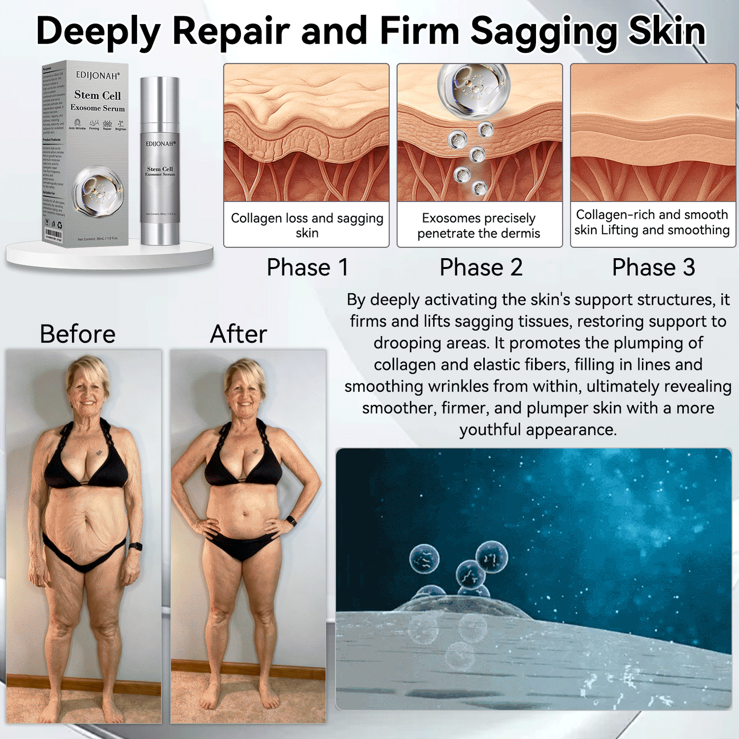 🌿𝐸𝐷𝐼𝐽𝑂𝑁𝐴𝐻®  🎯🎯𝑆𝑡𝑒𝑚 𝐶𝑒𝑙𝑙 𝐸𝑥𝑜𝑠𝑜𝑚𝑒 𝑆𝑒𝑟𝑢𝑚 -（ Anti-aging, reduces wrinkles, improves firmness, enhances radiance, provides deep hydration）