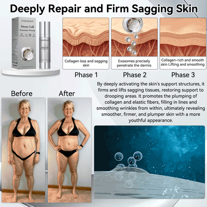 🌿𝐸𝐷𝐼𝐽𝑂𝑁𝐴𝐻®  🎯🎯𝑆𝑡𝑒𝑚 𝐶𝑒𝑙𝑙 𝐸𝑥𝑜𝑠𝑜𝑚𝑒 𝑆𝑒𝑟𝑢𝑚 -（ Anti-aging, reduces wrinkles, improves firmness, enhances radiance, provides deep hydration）