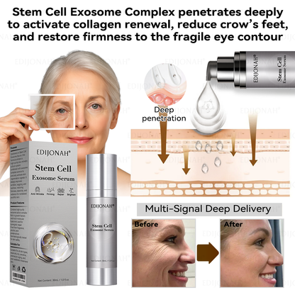 🌿𝐸𝐷𝐼𝐽𝑂𝑁𝐴𝐻®  🎯🎯𝑆𝑡𝑒𝑚 𝐶𝑒𝑙𝑙 𝐸𝑥𝑜𝑠𝑜𝑚𝑒 𝑆𝑒𝑟𝑢𝑚 -（ Anti-aging, reduces wrinkles, improves firmness, enhances radiance, provides deep hydration）