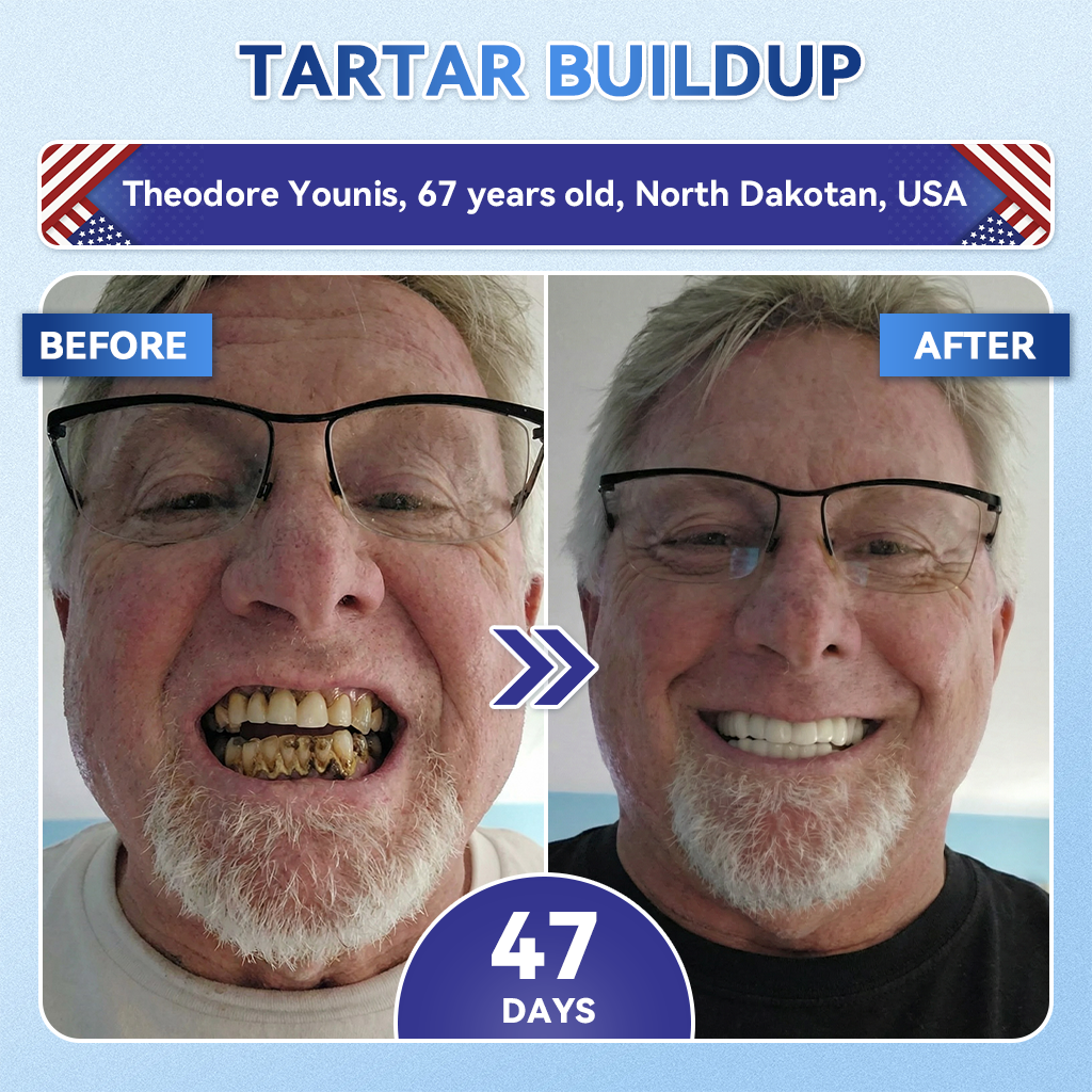 🦷𝐆𝐥𝐢𝐦𝐦𝐞𝐫𝐥𝐲® 𝐓𝐢𝐝𝐞𝐠𝐥𝐮𝐬𝐢𝐛 𝐓𝐨𝐨𝐭𝐡 & 𝐆𝐮𝐦 𝐑𝐞𝐩𝐚𝐢𝐫 𝐌𝐢𝐜𝐫𝐨𝐧𝐞𝐞𝐝𝐥𝐞 𝐏𝐚𝐭𝐜𝐡  |💝 𝐀𝐝𝐯𝐚𝐧𝐜𝐞𝐝 𝐒𝐭𝐞𝐦-𝐂𝐞𝐥𝐥 𝐀𝐜𝐭𝐢𝐯𝐚𝐭𝐢𝐨𝐧 𝐓𝐞𝐞𝐭𝐡 𝐒𝐭𝐫𝐢𝐩𝐬(🦷𝐑𝐞𝐛𝐮𝐢𝐥𝐝 𝐄𝐧𝐚𝐦𝐞𝐥 & 𝐃𝐞𝐧𝐭𝐢𝐧 • 𝐒𝐭𝐫𝐞𝐧𝐠𝐭𝐡𝐞𝐧 𝐆𝐮𝐦𝐬 • 𝐄𝐫𝐚𝐝𝐢𝐜𝐚𝐭𝐞 𝐓𝐚𝐫𝐭𝐚𝐫 & 𝐎𝐝𝐨𝐫 • 𝐒𝐭𝐨𝐩 𝐓𝐨𝐨𝐭𝐡 𝐒𝐞𝐧𝐬𝐢𝐭𝐢𝐯𝐢𝐭𝐲)