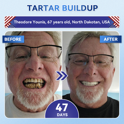 🦷𝐆𝐥𝐢𝐦𝐦𝐞𝐫𝐥𝐲® 𝐓𝐢𝐝𝐞𝐠𝐥𝐮𝐬𝐢𝐛 𝐓𝐨𝐨𝐭𝐡 & 𝐆𝐮𝐦 𝐑𝐞𝐩𝐚𝐢𝐫 𝐌𝐢𝐜𝐫𝐨𝐧𝐞𝐞𝐝𝐥𝐞 𝐏𝐚𝐭𝐜𝐡  |💝 𝐀𝐝𝐯𝐚𝐧𝐜𝐞𝐝 𝐒𝐭𝐞𝐦-𝐂𝐞𝐥𝐥 𝐀𝐜𝐭𝐢𝐯𝐚𝐭𝐢𝐨𝐧 𝐓𝐞𝐞𝐭𝐡 𝐒𝐭𝐫𝐢𝐩𝐬(🦷𝐑𝐞𝐛𝐮𝐢𝐥𝐝 𝐄𝐧𝐚𝐦𝐞𝐥 & 𝐃𝐞𝐧𝐭𝐢𝐧 • 𝐒𝐭𝐫𝐞𝐧𝐠𝐭𝐡𝐞𝐧 𝐆𝐮𝐦𝐬 • 𝐄𝐫𝐚𝐝𝐢𝐜𝐚𝐭𝐞 𝐓𝐚𝐫𝐭𝐚𝐫 & 𝐎𝐝𝐨𝐫 • 𝐒𝐭𝐨𝐩 𝐓𝐨𝐨𝐭𝐡 𝐒𝐞𝐧𝐬𝐢𝐭𝐢𝐯𝐢𝐭𝐲)