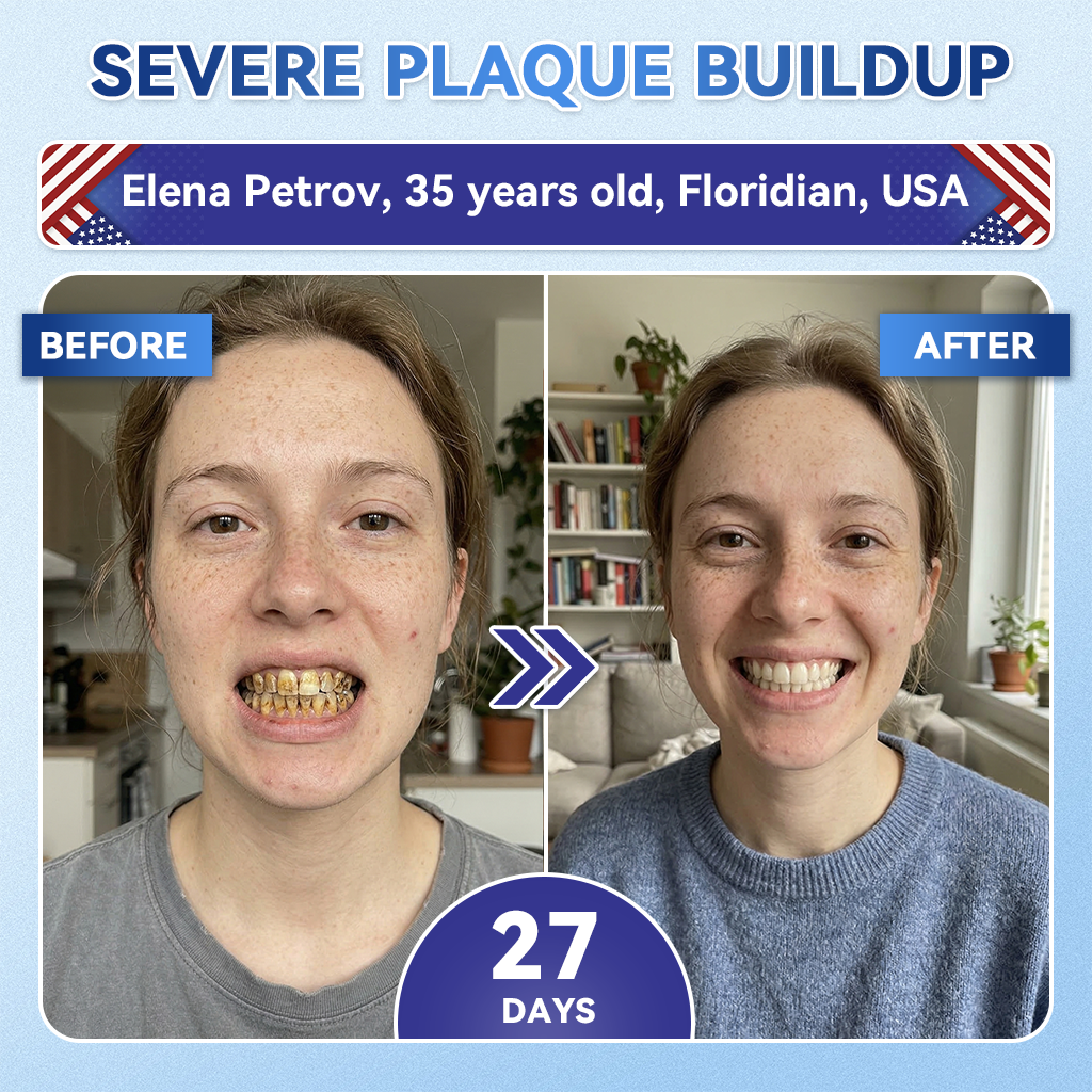 🦷𝐆𝐥𝐢𝐦𝐦𝐞𝐫𝐥𝐲® 𝐓𝐢𝐝𝐞𝐠𝐥𝐮𝐬𝐢𝐛 𝐓𝐨𝐨𝐭𝐡 & 𝐆𝐮𝐦 𝐑𝐞𝐩𝐚𝐢𝐫 𝐌𝐢𝐜𝐫𝐨𝐧𝐞𝐞𝐝𝐥𝐞 𝐏𝐚𝐭𝐜𝐡  |💝 𝐀𝐝𝐯𝐚𝐧𝐜𝐞𝐝 𝐒𝐭𝐞𝐦-𝐂𝐞𝐥𝐥 𝐀𝐜𝐭𝐢𝐯𝐚𝐭𝐢𝐨𝐧 𝐓𝐞𝐞𝐭𝐡 𝐒𝐭𝐫𝐢𝐩𝐬(🦷𝐑𝐞𝐛𝐮𝐢𝐥𝐝 𝐄𝐧𝐚𝐦𝐞𝐥 & 𝐃𝐞𝐧𝐭𝐢𝐧 • 𝐒𝐭𝐫𝐞𝐧𝐠𝐭𝐡𝐞𝐧 𝐆𝐮𝐦𝐬 • 𝐄𝐫𝐚𝐝𝐢𝐜𝐚𝐭𝐞 𝐓𝐚𝐫𝐭𝐚𝐫 & 𝐎𝐝𝐨𝐫 • 𝐒𝐭𝐨𝐩 𝐓𝐨𝐨𝐭𝐡 𝐒𝐞𝐧𝐬𝐢𝐭𝐢𝐯𝐢𝐭𝐲)