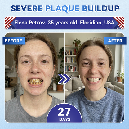 🦷𝐆𝐥𝐢𝐦𝐦𝐞𝐫𝐥𝐲® 𝐓𝐢𝐝𝐞𝐠𝐥𝐮𝐬𝐢𝐛 𝐓𝐨𝐨𝐭𝐡 & 𝐆𝐮𝐦 𝐑𝐞𝐩𝐚𝐢𝐫 𝐌𝐢𝐜𝐫𝐨𝐧𝐞𝐞𝐝𝐥𝐞 𝐏𝐚𝐭𝐜𝐡  |💝 𝐀𝐝𝐯𝐚𝐧𝐜𝐞𝐝 𝐒𝐭𝐞𝐦-𝐂𝐞𝐥𝐥 𝐀𝐜𝐭𝐢𝐯𝐚𝐭𝐢𝐨𝐧 𝐓𝐞𝐞𝐭𝐡 𝐒𝐭𝐫𝐢𝐩𝐬(🦷𝐑𝐞𝐛𝐮𝐢𝐥𝐝 𝐄𝐧𝐚𝐦𝐞𝐥 & 𝐃𝐞𝐧𝐭𝐢𝐧 • 𝐒𝐭𝐫𝐞𝐧𝐠𝐭𝐡𝐞𝐧 𝐆𝐮𝐦𝐬 • 𝐄𝐫𝐚𝐝𝐢𝐜𝐚𝐭𝐞 𝐓𝐚𝐫𝐭𝐚𝐫 & 𝐎𝐝𝐨𝐫 • 𝐒𝐭𝐨𝐩 𝐓𝐨𝐨𝐭𝐡 𝐒𝐞𝐧𝐬𝐢𝐭𝐢𝐯𝐢𝐭𝐲)