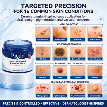 𝐏𝐢𝐜𝐝𝐨® 7-𝐃𝐚𝐲 𝐒𝐤𝐢𝐧 𝐓𝐚𝐠 & 𝐒𝐩𝐨𝐭 𝐄𝐫𝐚𝐬𝐞𝐫 𝐂𝐫𝐞𝐚𝐦 (Zero Pain, Zero 𝐒𝐜𝐚𝐫𝐬 Formula) 🌺