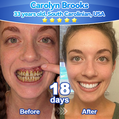 ✨🎇𝑃𝑖𝑐𝑑𝑜® 𝑆𝑡𝑒𝑚 𝐶𝑒𝑙𝑙 𝐺𝑖𝑛𝑔𝑖𝑣𝑎𝑙 𝑅𝑒𝑝𝑎𝑖𝑟 𝑀𝑜𝑢𝑠𝑠𝑒(🦷Promote Tooth Regrowth • Remove Tartar • Strengthen Gums • Deep Clean & Freshen Breath)