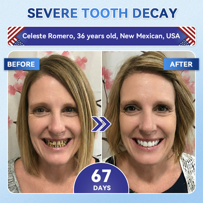 🦷𝐆𝐥𝐢𝐦𝐦𝐞𝐫𝐥𝐲® 𝐓𝐢𝐝𝐞𝐠𝐥𝐮𝐬𝐢𝐛 𝐓𝐨𝐨𝐭𝐡 & 𝐆𝐮𝐦 𝐑𝐞𝐩𝐚𝐢𝐫 𝐌𝐢𝐜𝐫𝐨𝐧𝐞𝐞𝐝𝐥𝐞 𝐏𝐚𝐭𝐜𝐡  |💝 𝐀𝐝𝐯𝐚𝐧𝐜𝐞𝐝 𝐒𝐭𝐞𝐦-𝐂𝐞𝐥𝐥 𝐀𝐜𝐭𝐢𝐯𝐚𝐭𝐢𝐨𝐧 𝐓𝐞𝐞𝐭𝐡 𝐒𝐭𝐫𝐢𝐩𝐬(🦷𝐑𝐞𝐛𝐮𝐢𝐥𝐝 𝐄𝐧𝐚𝐦𝐞𝐥 & 𝐃𝐞𝐧𝐭𝐢𝐧 • 𝐒𝐭𝐫𝐞𝐧𝐠𝐭𝐡𝐞𝐧 𝐆𝐮𝐦𝐬 • 𝐄𝐫𝐚𝐝𝐢𝐜𝐚𝐭𝐞 𝐓𝐚𝐫𝐭𝐚𝐫 & 𝐎𝐝𝐨𝐫 • 𝐒𝐭𝐨𝐩 𝐓𝐨𝐨𝐭𝐡 𝐒𝐞𝐧𝐬𝐢𝐭𝐢𝐯𝐢𝐭𝐲)