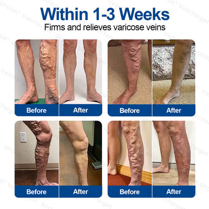 ✅𝐅𝐥𝐨𝐫𝐢𝐬𝐦𝐚® 𝐕𝐞𝐢𝐧𝐓𝐚𝐫𝐠𝐞𝐭 𝐌𝐢𝐜𝐫𝐨𝐧𝐞𝐞𝐝𝐥𝐞 𝐏𝐚𝐭𝐜𝐡⚡Instant Relief, Long-Term Results 美国