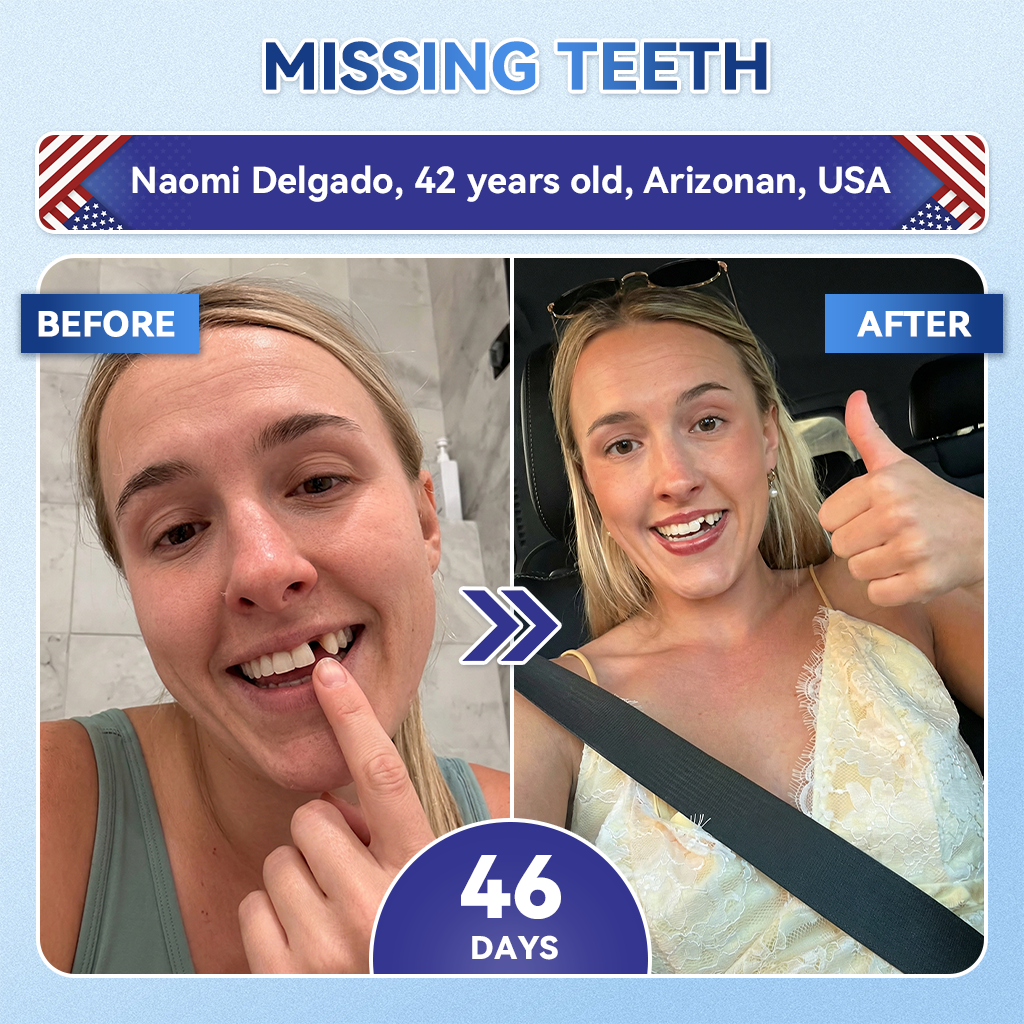 ⏰ Last slot remaining! ⚡ Get 30% OFF — limited time only!🦷𝐆𝐥𝐢𝐦𝐦𝐞𝐫𝐥𝐲® 𝐓𝐢𝐝𝐞𝐠𝐥𝐮𝐬𝐢𝐛 𝐓𝐨𝐨𝐭𝐡 & 𝐆𝐮𝐦 𝐑𝐞𝐩𝐚𝐢𝐫 𝐌𝐢𝐜𝐫𝐨𝐧𝐞𝐞𝐝𝐥𝐞 𝐏𝐚𝐭𝐜𝐡