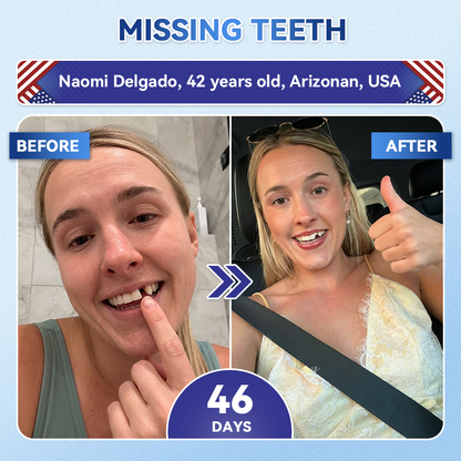 ⏰ Last slot remaining! ⚡ Get 30% OFF — limited time only!🦷𝐆𝐥𝐢𝐦𝐦𝐞𝐫𝐥𝐲® 𝐓𝐢𝐝𝐞𝐠𝐥𝐮𝐬𝐢𝐛 𝐓𝐨𝐨𝐭𝐡 & 𝐆𝐮𝐦 𝐑𝐞𝐩𝐚𝐢𝐫 𝐌𝐢𝐜𝐫𝐨𝐧𝐞𝐞𝐝𝐥𝐞 𝐏𝐚𝐭𝐜𝐡