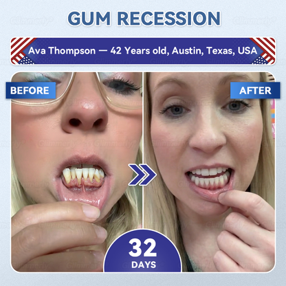 🌿🦷𝐆𝐥𝐢𝐦𝐦𝐞𝐫𝐥𝐲® 𝐓𝐢𝐝𝐞𝐠𝐥𝐮𝐬𝐢𝐛 𝐓𝐨𝐨𝐭𝐡 & 𝐆𝐮𝐦 𝐑𝐞𝐩𝐚𝐢𝐫 𝐌𝐢𝐜𝐫𝐨𝐧𝐞𝐞𝐝𝐥𝐞 𝐏𝐚𝐭𝐜𝐡 💕 | 𝐀𝐝𝐯𝐚𝐧𝐜𝐞𝐝 𝐒𝐭𝐞𝐦-𝐂𝐞𝐥𝐥 𝐀𝐜𝐭𝐢𝐯𝐚𝐭𝐢𝐨𝐧 𝐓𝐞𝐞𝐭𝐡 𝐒𝐭𝐫𝐢𝐩𝐬(🦷𝐑𝐞𝐛𝐮𝐢𝐥𝐝 𝐄𝐧𝐚𝐦𝐞𝐥 & 𝐃𝐞𝐧𝐭𝐢𝐧 • 𝐒𝐭𝐫𝐞𝐧𝐠𝐭𝐡𝐞𝐧 𝐆𝐮𝐦𝐬 • 𝐄𝐫𝐚𝐝𝐢𝐜𝐚𝐭𝐞 𝐓𝐚𝐫𝐭𝐚𝐫 & 𝐎𝐝𝐨𝐫 • 𝐒𝐭𝐨𝐩 𝐓𝐨𝐨𝐭𝐡 𝐒𝐞𝐧𝐬𝐢𝐭𝐢𝐯𝐢𝐭𝐲)