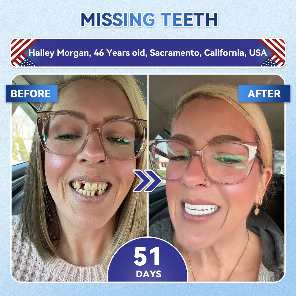 ⏰ Last slot remaining! ⚡ Get 30% OFF — limited time only!🦷𝐆𝐥𝐢𝐦𝐦𝐞𝐫𝐥𝐲® 𝐓𝐢𝐝𝐞𝐠𝐥𝐮𝐬𝐢𝐛 𝐓𝐨𝐨𝐭𝐡 & 𝐆𝐮𝐦 𝐑𝐞𝐩𝐚𝐢𝐫 𝐌𝐢𝐜𝐫𝐨𝐧𝐞𝐞𝐝𝐥𝐞 𝐏𝐚𝐭𝐜𝐡
