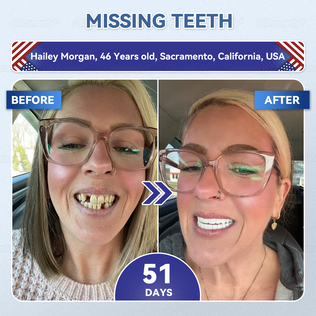 🌿🦷𝐆𝐥𝐢𝐦𝐦𝐞𝐫𝐥𝐲® 𝐓𝐢𝐝𝐞𝐠𝐥𝐮𝐬𝐢𝐛 𝐓𝐨𝐨𝐭𝐡 & 𝐆𝐮𝐦 𝐑𝐞𝐩𝐚𝐢𝐫 𝐌𝐢𝐜𝐫𝐨𝐧𝐞𝐞𝐝𝐥𝐞 𝐏𝐚𝐭𝐜𝐡 💕 | 𝐀𝐝𝐯𝐚𝐧𝐜𝐞𝐝 𝐒𝐭𝐞𝐦-𝐂𝐞𝐥𝐥 𝐀𝐜𝐭𝐢𝐯𝐚𝐭𝐢𝐨𝐧 𝐓𝐞𝐞𝐭𝐡 𝐒𝐭𝐫𝐢𝐩𝐬(🦷𝐑𝐞𝐛𝐮𝐢𝐥𝐝 𝐄𝐧𝐚𝐦𝐞𝐥 & 𝐃𝐞𝐧𝐭𝐢𝐧 • 𝐒𝐭𝐫𝐞𝐧𝐠𝐭𝐡𝐞𝐧 𝐆𝐮𝐦𝐬 • 𝐄𝐫𝐚𝐝𝐢𝐜𝐚𝐭𝐞 𝐓𝐚𝐫𝐭𝐚𝐫 & 𝐎𝐝𝐨𝐫 • 𝐒𝐭𝐨𝐩 𝐓𝐨𝐨𝐭𝐡 𝐒𝐞𝐧𝐬𝐢𝐭𝐢𝐯𝐢𝐭𝐲)