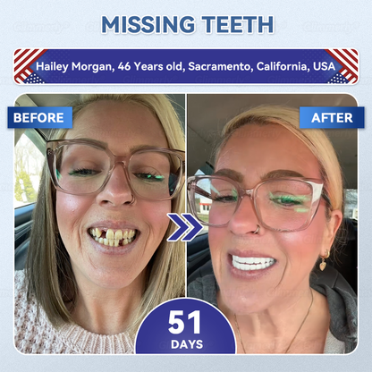 🌿🦷𝐆𝐥𝐢𝐦𝐦𝐞𝐫𝐥𝐲® 𝐓𝐢𝐝𝐞𝐠𝐥𝐮𝐬𝐢𝐛 𝐓𝐨𝐨𝐭𝐡 & 𝐆𝐮𝐦 𝐑𝐞𝐩𝐚𝐢𝐫 𝐌𝐢𝐜𝐫𝐨𝐧𝐞𝐞𝐝𝐥𝐞 𝐏𝐚𝐭𝐜𝐡 💕 | 𝐀𝐝𝐯𝐚𝐧𝐜𝐞𝐝 𝐒𝐭𝐞𝐦-𝐂𝐞𝐥𝐥 𝐀𝐜𝐭𝐢𝐯𝐚𝐭𝐢𝐨𝐧 𝐓𝐞𝐞𝐭𝐡 𝐒𝐭𝐫𝐢𝐩𝐬(🦷𝐑𝐞𝐛𝐮𝐢𝐥𝐝 𝐄𝐧𝐚𝐦𝐞𝐥 & 𝐃𝐞𝐧𝐭𝐢𝐧 • 𝐒𝐭𝐫𝐞𝐧𝐠𝐭𝐡𝐞𝐧 𝐆𝐮𝐦𝐬 • 𝐄𝐫𝐚𝐝𝐢𝐜𝐚𝐭𝐞 𝐓𝐚𝐫𝐭𝐚𝐫 & 𝐎𝐝𝐨𝐫 • 𝐒𝐭𝐨𝐩 𝐓𝐨𝐨𝐭𝐡 𝐒𝐞𝐧𝐬𝐢𝐭𝐢𝐯𝐢𝐭𝐲)