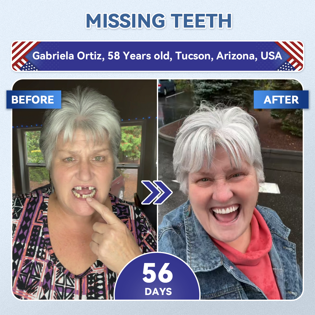 🌿🦷𝐆𝐥𝐢𝐦𝐦𝐞𝐫𝐥𝐲® 𝐓𝐢𝐝𝐞𝐠𝐥𝐮𝐬𝐢𝐛 𝐓𝐨𝐨𝐭𝐡 & 𝐆𝐮𝐦 𝐑𝐞𝐩𝐚𝐢𝐫 𝐌𝐢𝐜𝐫𝐨𝐧𝐞𝐞𝐝𝐥𝐞 𝐏𝐚𝐭𝐜𝐡 💕 | 𝐀𝐝𝐯𝐚𝐧𝐜𝐞𝐝 𝐒𝐭𝐞𝐦-𝐂𝐞𝐥𝐥 𝐀𝐜𝐭𝐢𝐯𝐚𝐭𝐢𝐨𝐧 𝐓𝐞𝐞𝐭𝐡 𝐒𝐭𝐫𝐢𝐩𝐬(🦷𝐑𝐞𝐛𝐮𝐢𝐥𝐝 𝐄𝐧𝐚𝐦𝐞𝐥 & 𝐃𝐞𝐧𝐭𝐢𝐧 • 𝐒𝐭𝐫𝐞𝐧𝐠𝐭𝐡𝐞𝐧 𝐆𝐮𝐦𝐬 • 𝐄𝐫𝐚𝐝𝐢𝐜𝐚𝐭𝐞 𝐓𝐚𝐫𝐭𝐚𝐫 & 𝐎𝐝𝐨𝐫 • 𝐒𝐭𝐨𝐩 𝐓𝐨𝐨𝐭𝐡 𝐒𝐞𝐧𝐬𝐢𝐭𝐢𝐯𝐢𝐭𝐲)