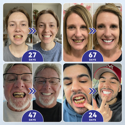 🌿🦷𝐆𝐥𝐢𝐦𝐦𝐞𝐫𝐥𝐲® 𝐓𝐢𝐝𝐞𝐠𝐥𝐮𝐬𝐢𝐛 𝐓𝐨𝐨𝐭𝐡 & 𝐆𝐮𝐦 𝐑𝐞𝐩𝐚𝐢𝐫 𝐌𝐢𝐜𝐫𝐨𝐧𝐞𝐞𝐝𝐥𝐞 𝐏𝐚𝐭𝐜𝐡 💕 | 𝐀𝐝𝐯𝐚𝐧𝐜𝐞𝐝 𝐒𝐭𝐞𝐦-𝐂𝐞𝐥𝐥 𝐀𝐜𝐭𝐢𝐯𝐚𝐭𝐢𝐨𝐧 𝐓𝐞𝐞𝐭𝐡 𝐒𝐭𝐫𝐢𝐩𝐬(🦷𝐑𝐞𝐛𝐮𝐢𝐥𝐝 𝐄𝐧𝐚𝐦𝐞𝐥 & 𝐃𝐞𝐧𝐭𝐢𝐧 • 𝐒𝐭𝐫𝐞𝐧𝐠𝐭𝐡𝐞𝐧 𝐆𝐮𝐦𝐬 • 𝐄𝐫𝐚𝐝𝐢𝐜𝐚𝐭𝐞 𝐓𝐚𝐫𝐭𝐚𝐫 & 𝐎𝐝𝐨𝐫 • 𝐒𝐭𝐨𝐩 𝐓𝐨𝐨𝐭𝐡 𝐒𝐞𝐧𝐬𝐢𝐭𝐢𝐯𝐢𝐭𝐲)