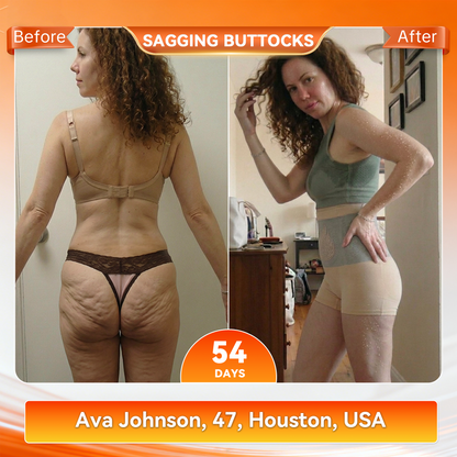 PAURAJU® 💦30-Min All-in-One Micro-Particle Fat-Burning Shorts✅Ignites deep microcirculation to melt fat, flush toxins, and reverse metabolic aging.🚗