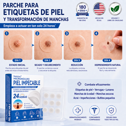 👩‍⚕️🎁𝑻𝒊𝒆𝒏𝒅𝒂 𝑶𝒇𝒊𝒄𝒊𝒂𝒍 | 𝖓𝖊𝕜𝕚𝕤𝕤®🌿 𝑀𝑖𝑐𝑟𝑜𝑎𝑔𝑢𝑗𝑎𝑠 𝑃𝑖𝑒𝑙 𝐼𝑚𝑝𝑒𝑐𝑎𝑏𝑙𝑒 𝐸𝑙𝑖𝑚𝑖𝑛𝑎𝑐𝑖ó𝑛 𝐷𝑒 𝑉𝑒𝑟𝑟𝑢𝑔𝑎𝑠 𝑃𝑎𝑟𝑐ℎ𝑒 (𝑃𝑎𝑟𝑎 𝑎𝑐𝑟𝑜𝑐𝑜𝑟𝑑𝑜𝑛𝑒𝑠, 𝑝𝑒𝑞𝑢𝑒ñ𝑎𝑠 𝑖𝑚𝑝𝑒𝑟𝑓𝑒𝑐𝑐𝑖𝑜𝑛𝑒𝑠 𝑐𝑢𝑡á𝑛𝑒𝑎𝑠, 𝑣𝑒𝑟𝑟𝑢𝑔𝑎𝑠, 𝑙𝑢𝑛𝑎𝑟𝑒𝑠, 𝑚𝑎𝑛𝑐ℎ𝑎𝑠 𝑑𝑒 𝑙𝑎 𝑒𝑑𝑎𝑑 𝑦 𝑝𝑟𝑜𝑏𝑙𝑒𝑚𝑎𝑠 𝑑𝑒 𝑝𝑖𝑔𝑚𝑒𝑛𝑡𝑎𝑐𝑖ó𝑛.)