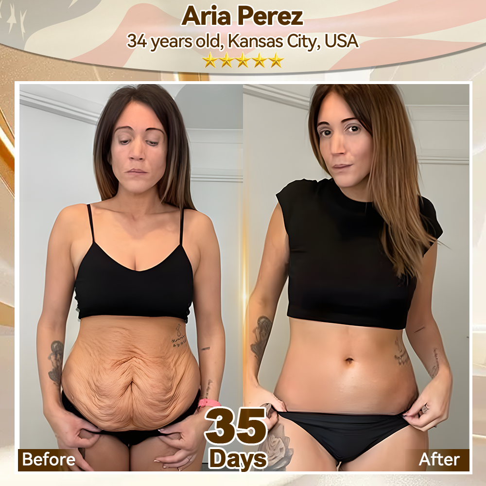 𝗘𝗗𝗜𝗝𝐎𝗡𝗔𝗛®💎𝗦𝘁𝒆𝗺 𝗖𝒆𝗹𝗹 𝗘𝘅𝗼𝘀𝗼𝗺𝙚 𝗦𝗲𝗿𝘂𝒎 -（𝖠𝗇𝗍𝗂-𝖺𝗀𝗂𝗇𝗀, 𝗋𝖾𝖽𝗎𝖼𝖾𝗌 𝗐𝗋𝗂𝗇𝗄𝗅𝖾𝗌, 𝗂𝗆𝗉𝗋𝗈𝗏𝖾𝗌 𝖿𝗂𝗋𝗆𝗇𝖾𝗌𝗌, 𝖾𝗇𝗁𝖺𝗇𝖼𝖾𝗌 𝗋𝖺𝖽𝗂𝖺𝗇𝖼𝖾, 𝗉𝗋𝗈𝗏𝗂𝖽𝖾𝗌 𝖽𝖾𝖾𝗉 𝗁𝗒𝖽𝗋𝖺𝗍𝗂𝗈𝗇）