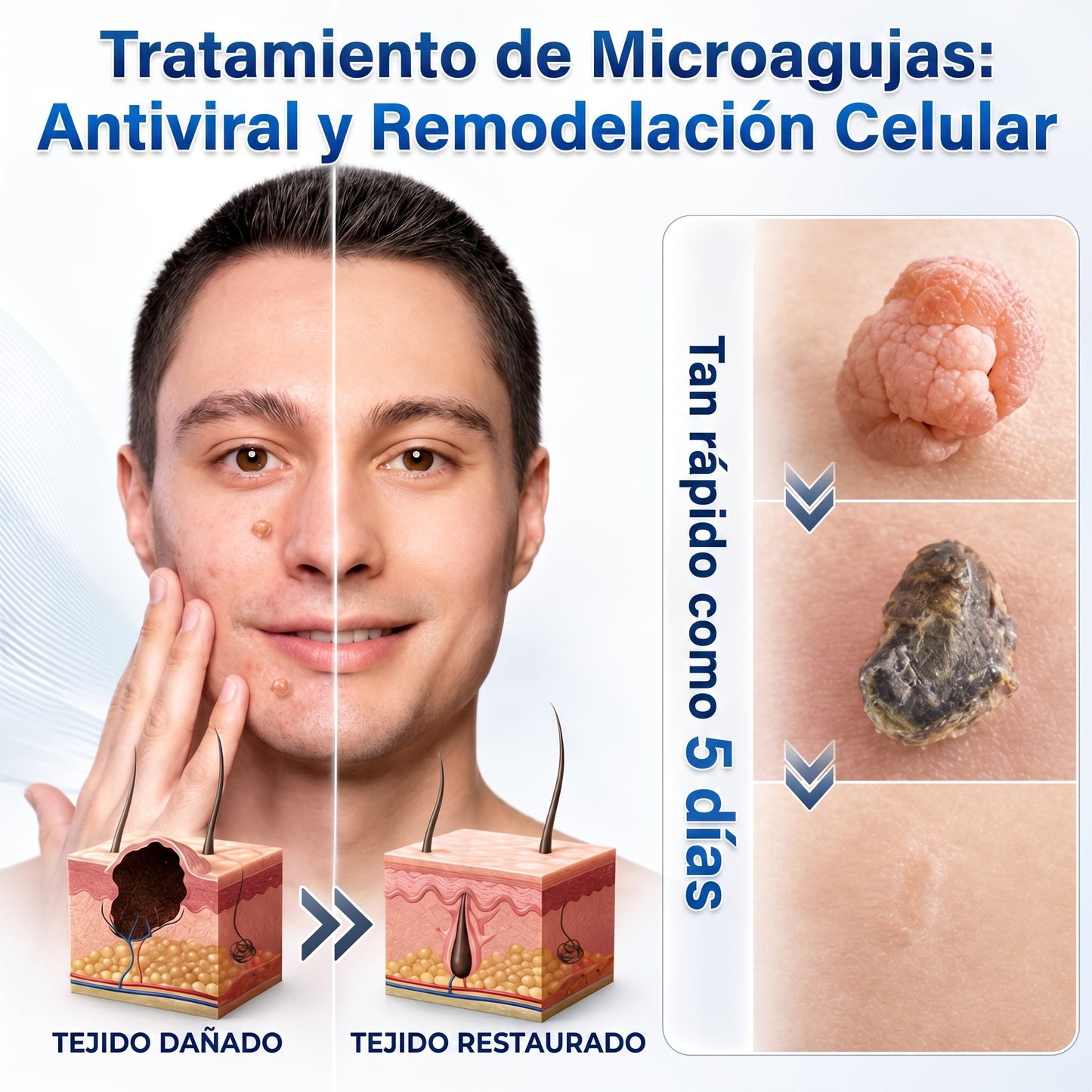 👩‍⚕️🎁𝑻𝒊𝒆𝒏𝒅𝒂 𝑶𝒇𝒊𝒄𝒊𝒂𝒍 | 𝖓𝖊𝕜𝕚𝕤𝕤®🌿 𝑀𝑖𝑐𝑟𝑜𝑎𝑔𝑢𝑗𝑎𝑠 𝑃𝑖𝑒𝑙 𝐼𝑚𝑝𝑒𝑐𝑎𝑏𝑙𝑒 𝐸𝑙𝑖𝑚𝑖𝑛𝑎𝑐𝑖ó𝑛 𝐷𝑒 𝑉𝑒𝑟𝑟𝑢𝑔𝑎𝑠 𝑃𝑎𝑟𝑐ℎ𝑒 (𝑃𝑎𝑟𝑎 𝑎𝑐𝑟𝑜𝑐𝑜𝑟𝑑𝑜𝑛𝑒𝑠, 𝑝𝑒𝑞𝑢𝑒ñ𝑎𝑠 𝑖𝑚𝑝𝑒𝑟𝑓𝑒𝑐𝑐𝑖𝑜𝑛𝑒𝑠 𝑐𝑢𝑡á𝑛𝑒𝑎𝑠, 𝑣𝑒𝑟𝑟𝑢𝑔𝑎𝑠, 𝑙𝑢𝑛𝑎𝑟𝑒𝑠, 𝑚𝑎𝑛𝑐ℎ𝑎𝑠 𝑑𝑒 𝑙𝑎 𝑒𝑑𝑎𝑑 𝑦 𝑝𝑟𝑜𝑏𝑙𝑒𝑚𝑎𝑠 𝑑𝑒 𝑝𝑖𝑔𝑚𝑒𝑛𝑡𝑎𝑐𝑖ó𝑛.)