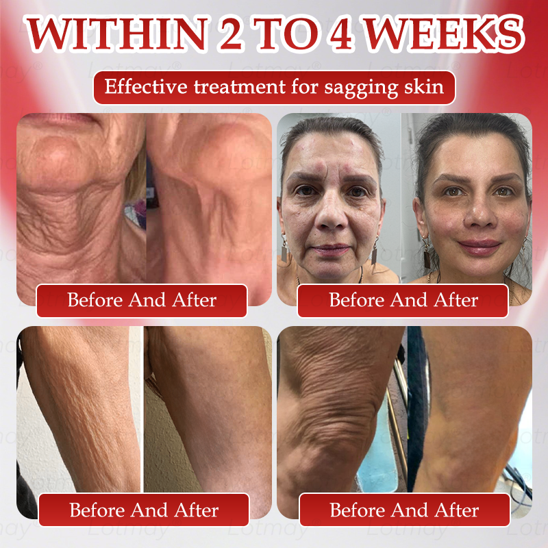 M𝖺𝖽e in USA⚡𝗟𝗼𝘁m𝖺y® 𝗡𝗠𝖭 N𝖠𝙳+ 𝙱𝚘𝗈s𝗍 F𝗂𝗋mi𝗇g & A𝚗𝚝i-𝖺𝗀𝗂𝗇𝗀 𝖮𝗋𝚊l Li𝗾𝘂𝗶d