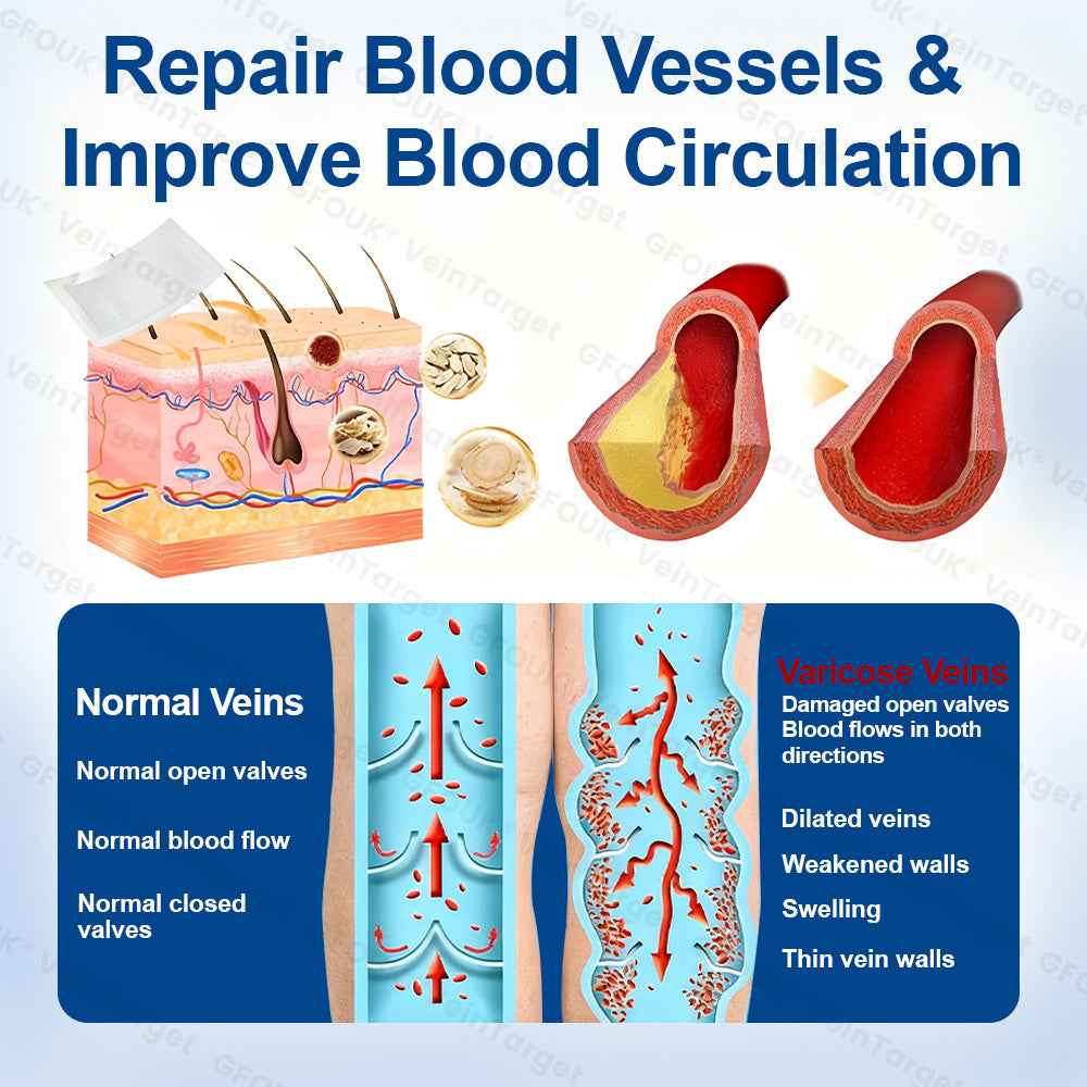✅𝐅𝐥𝐨𝐫𝐢𝐬𝐦𝐚® 𝐕𝐞𝐢𝐧𝐓𝐚𝐫𝐠𝐞𝐭 𝐌𝐢𝐜𝐫𝐨𝐧𝐞𝐞𝐝𝐥𝐞 𝐏𝐚𝐭𝐜𝐡⚡Instant Relief, Long-Term Results 美国
