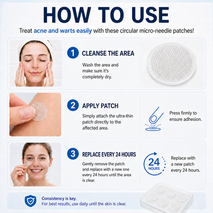 👩‍⚕️🎁 𝐎𝐟𝐟𝐢𝐜𝐢𝐚𝐥 𝐒𝐭𝐨𝐫𝐞 | 𝑵𝐞𝒌𝐢𝐬𝐬® 🌿 𝐁𝐨𝐭𝐚𝐧𝐢𝐜𝐚𝐥 𝐌𝐢𝐜𝐫𝐨𝐧𝐞𝐞𝐝𝐥𝐞 𝐇𝐲𝐝𝐫𝐨𝐜𝐨𝐥𝐥𝐨𝐢𝐝 𝐏𝐚𝐭𝐜𝐡 (𝐅𝐨𝐫 𝐒𝐤𝐢𝐧 𝐓𝐚𝐠𝐬, 𝐒𝐦𝐚𝐥𝐥 𝐒𝐤𝐢𝐧 𝐆𝐫𝐨𝐰𝐭𝐡𝐬, 𝐖𝐚𝐫𝐭𝐬, 𝐌𝐨𝐥𝐞𝐬, 𝐀𝐠𝐞 𝐒𝐩𝐨𝐭𝐬 & 𝐏𝐢𝐠𝐦𝐞𝐧𝐭𝐚𝐭𝐢𝐨𝐧 𝐂𝐨𝐧𝐜𝐞𝐫𝐧𝐬)