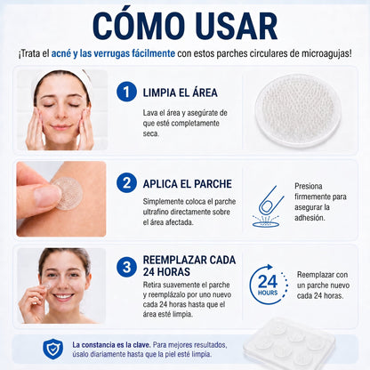 👩‍⚕️🎁𝑻𝒊𝒆𝒏𝒅𝒂 𝑶𝒇𝒊𝒄𝒊𝒂𝒍 | 𝖓𝖊𝕜𝕚𝕤𝕤®🌿 𝑀𝑖𝑐𝑟𝑜𝑎𝑔𝑢𝑗𝑎𝑠 𝑃𝑖𝑒𝑙 𝐼𝑚𝑝𝑒𝑐𝑎𝑏𝑙𝑒 𝐸𝑙𝑖𝑚𝑖𝑛𝑎𝑐𝑖ó𝑛 𝐷𝑒 𝑉𝑒𝑟𝑟𝑢𝑔𝑎𝑠 𝑃𝑎𝑟𝑐ℎ𝑒 (𝑃𝑎𝑟𝑎 𝑎𝑐𝑟𝑜𝑐𝑜𝑟𝑑𝑜𝑛𝑒𝑠, 𝑝𝑒𝑞𝑢𝑒ñ𝑎𝑠 𝑖𝑚𝑝𝑒𝑟𝑓𝑒𝑐𝑐𝑖𝑜𝑛𝑒𝑠 𝑐𝑢𝑡á𝑛𝑒𝑎𝑠, 𝑣𝑒𝑟𝑟𝑢𝑔𝑎𝑠, 𝑙𝑢𝑛𝑎𝑟𝑒𝑠, 𝑚𝑎𝑛𝑐ℎ𝑎𝑠 𝑑𝑒 𝑙𝑎 𝑒𝑑𝑎𝑑 𝑦 𝑝𝑟𝑜𝑏𝑙𝑒𝑚𝑎𝑠 𝑑𝑒 𝑝𝑖𝑔𝑚𝑒𝑛𝑡𝑎𝑐𝑖ó𝑛.)