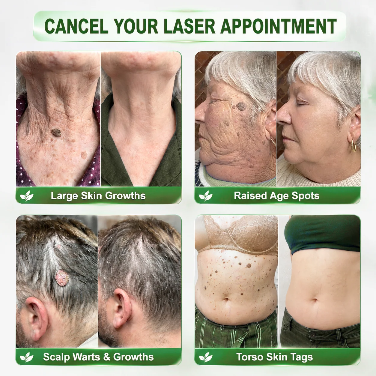 👩‍⚕️🎁 𝐎𝐟𝐟𝐢𝐜𝐢𝐚𝐥 𝐒𝐭𝐨𝐫𝐞🌈𝑷𝑫𝑹𝑵 Anti-Aging & Targeted Spot Renewal Stick (Hilft Falten zu glätten, fördert straffer aussehende Haut und verbessert das Erscheinungsbild sichtbarer Flecken)