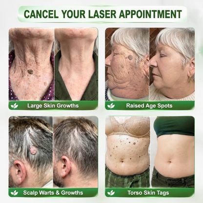 👩‍⚕️🎁 𝐎𝐟𝐟𝐢𝐜𝐢𝐚𝐥 𝐒𝐭𝐨𝐫𝐞🌈𝑷𝑫𝑹𝑵 Anti-Aging & Targeted Spot Renewal Stick (Hilft Falten zu glätten, fördert straffer aussehende Haut und verbessert das Erscheinungsbild sichtbarer Flecken)