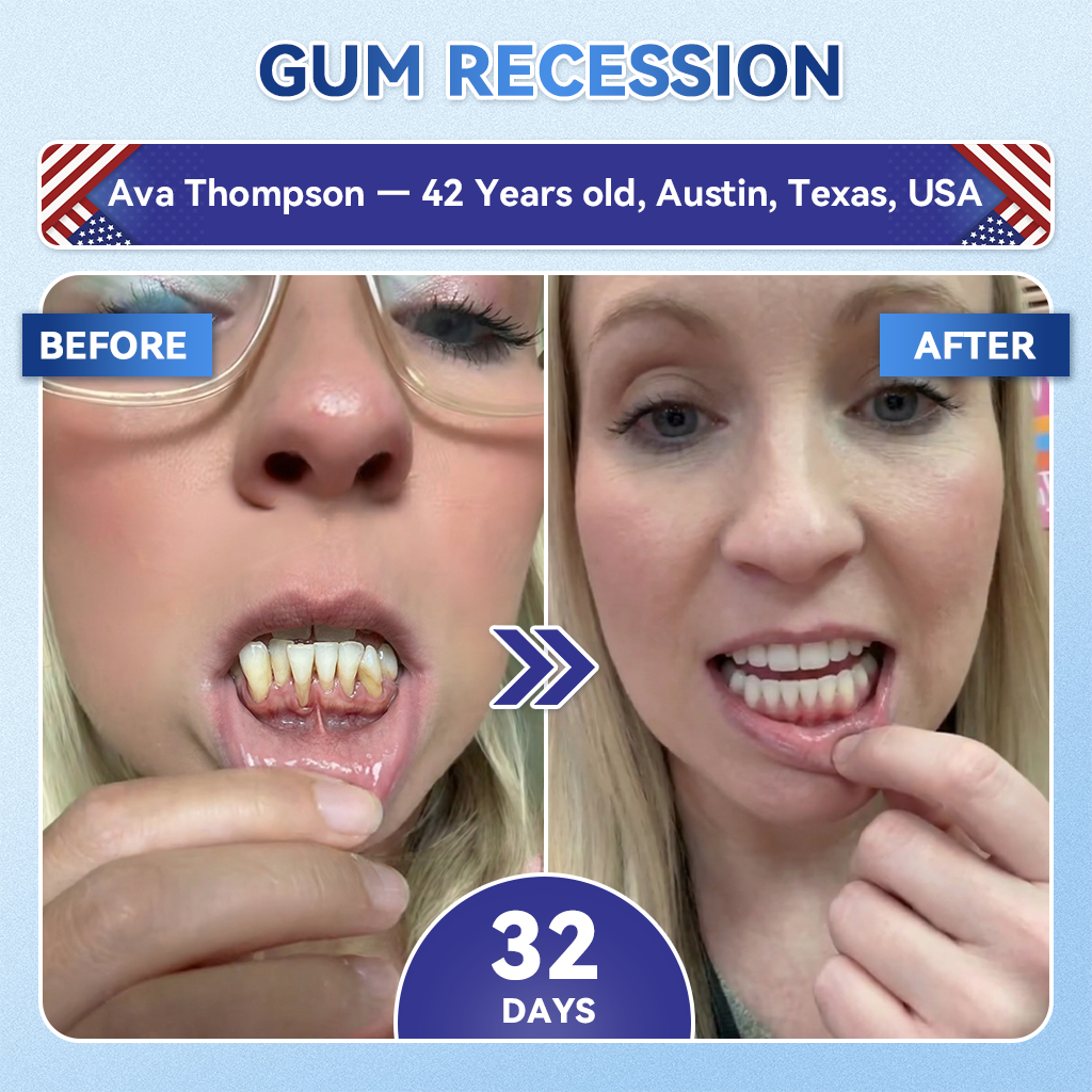 ⏰ Last slot remaining! ⚡ Get 30% OFF — limited time only!🦷𝐆𝐥𝐢𝐦𝐦𝐞𝐫𝐥𝐲® 𝐓𝐢𝐝𝐞𝐠𝐥𝐮𝐬𝐢𝐛 𝐓𝐨𝐨𝐭𝐡 & 𝐆𝐮𝐦 𝐑𝐞𝐩𝐚𝐢𝐫 𝐌𝐢𝐜𝐫𝐨𝐧𝐞𝐞𝐝𝐥𝐞 𝐏𝐚𝐭𝐜𝐡