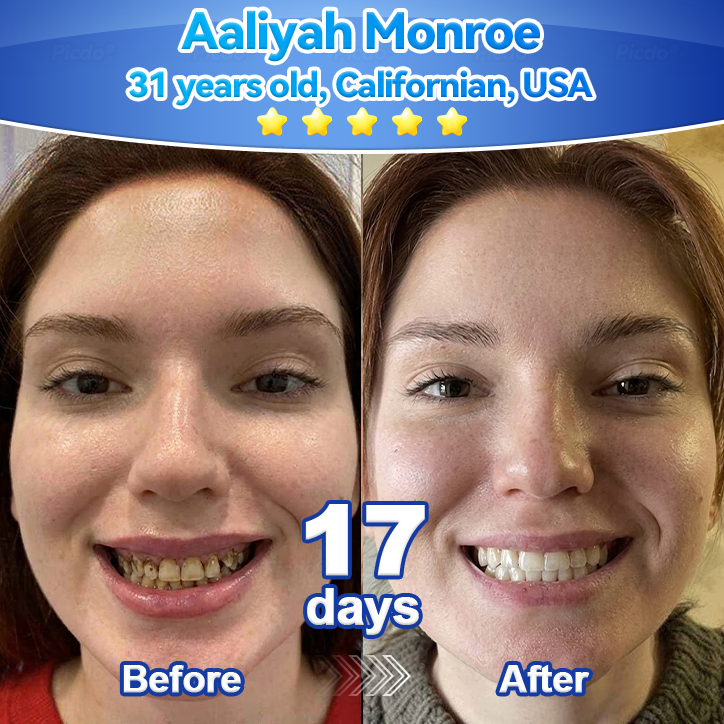 ✨🎇𝑃𝑖𝑐𝑑𝑜® 𝑆𝑡𝑒𝑚 𝐶𝑒𝑙𝑙 𝐺𝑖𝑛𝑔𝑖𝑣𝑎𝑙 𝑅𝑒𝑝𝑎𝑖𝑟 𝑀𝑜𝑢𝑠𝑠𝑒(🦷Promote Tooth Regrowth • Remove Tartar • Strengthen Gums • Deep Clean & Freshen Breath)